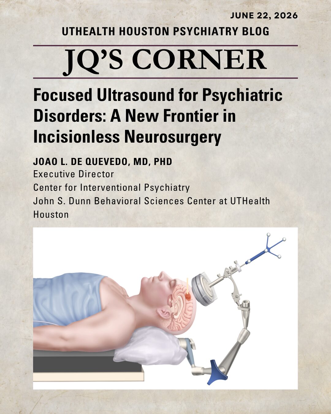 image of focused ultrasound jq corner blog post
