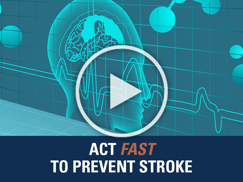 image for McGovern Medical Minute: Stroke