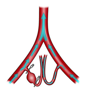 Pica Illustration