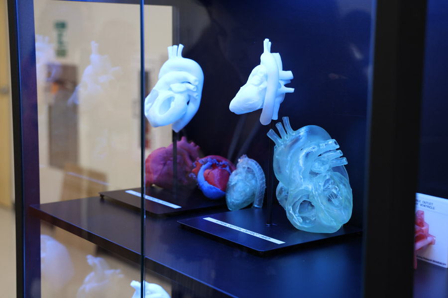 3D-printed anatomical heart models displayed in a glass case, showing detailed structures in translucent and colored materials used for medical education or research.