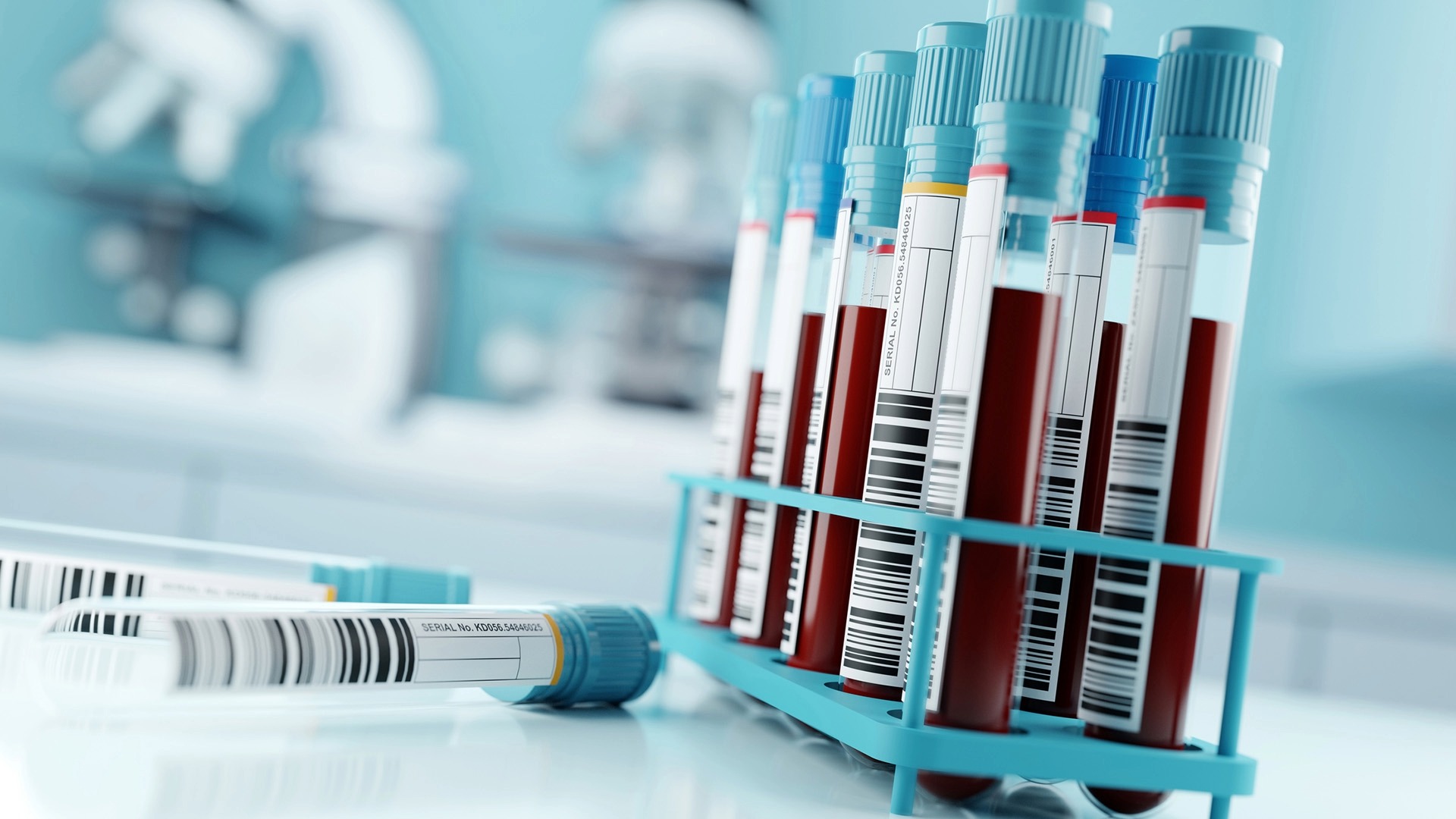 Test tube vials containing blood samples are ready for research