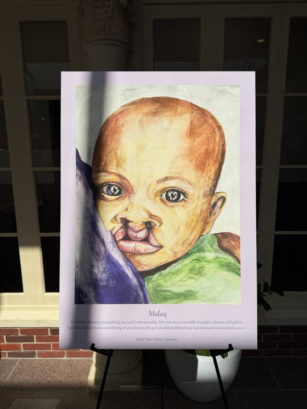 A colorful portrait of an infant named Malaq, born with a cleft difference, displayed on an easel as part of the 100 Cleft Portraits Tour.