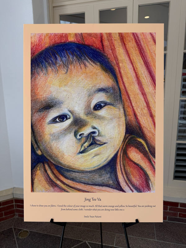 A colorful portrait of an infant named Jing Yee Va, born with a cleft difference, displayed on an easel during the 100 Cleft Portraits Tour.